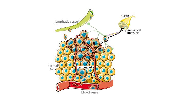 IMAGE 1 WILSON visual abstract UPDATED