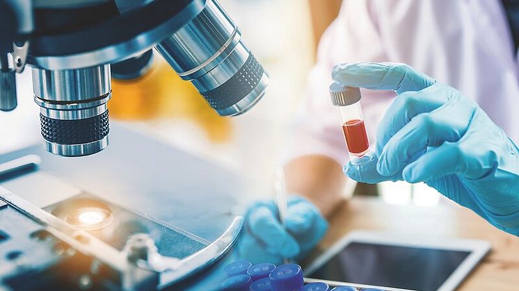 Im Rahmen der Dr. Rusche-Forschungsförderung werden Biomarker gesucht, die auf ein erhöhtes Risiko für Komplikationen nach einem herzchirurgischen Eingriff hinweisen.
