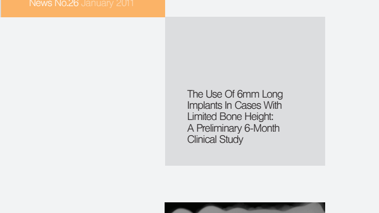 The use of 6mm long implants in cases with limited bone hight