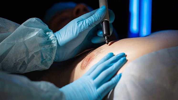 main-banner-Is-Scarless-Gynecomastia-Surgery-Medically-Possible