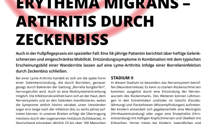 Erythema migrans - Arthritis durch Zeckenbiss