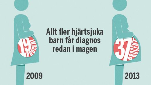 Hjärtrapporten 2015: Fler diagnoser ställs under fosterstadiet