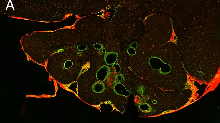 Brain section no propranolol
