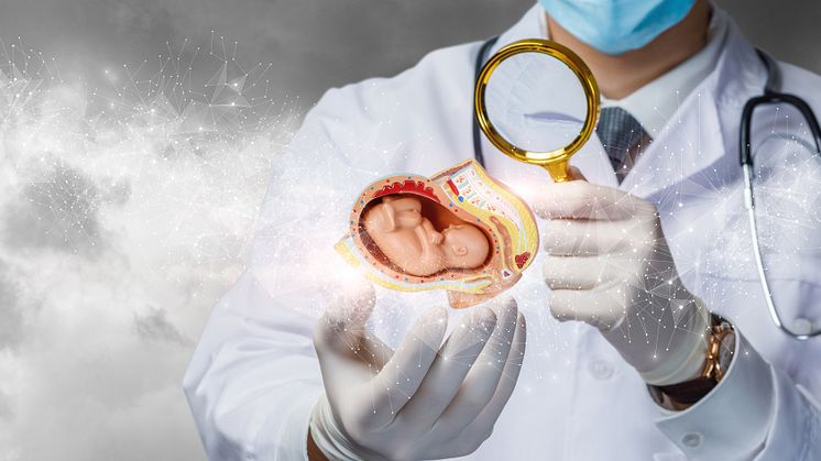 Bekymringsverdig utvikling av aborttallene på Downs syndrom