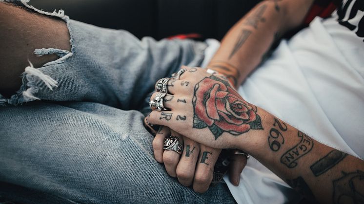 How to get your tattoo removed