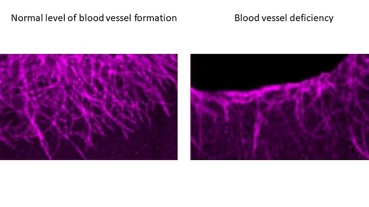 Mechanism for the formation of new blood vessels discovered