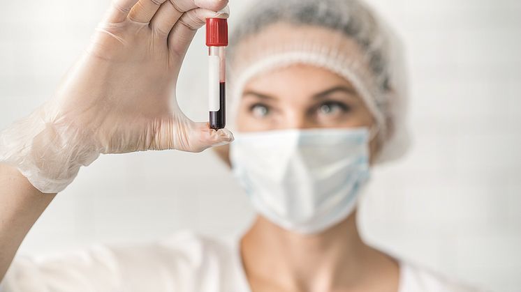 GcfDNA: Innovativer Biomarker für optimierte Überwachung und individualisierte Nachsorge von Transplantationspatienten