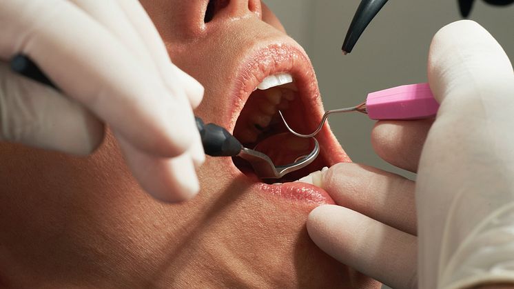 40 procent af Danmarks voksne befolkning – svarende til over 2,3 millioner mennesker – lider af varierende grader af parodontitis, men kun omkring 12-14 procent er i behandling herfor.