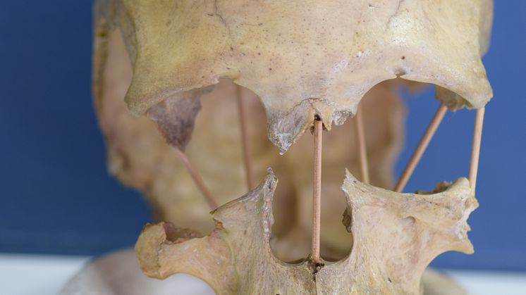 Peştera Muierii 1 skull