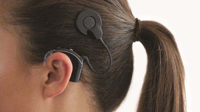 Cochlear™ Nucleus® 7 Soundprozessor