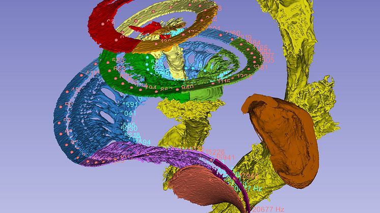 Ear membrane and auditory nerve in the cochlea. Humans can perceive frequencies from 20 Hz (the top of the coil) to 20,000 Hz (the base of the coil). Credit: Hao Li