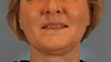 Tina-Honeré-Kongsoe-Lille