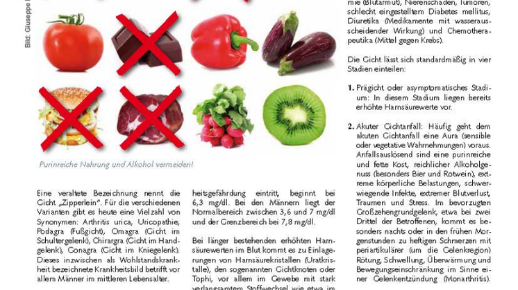 Fußgicht – Podagra: Zu viele Purine