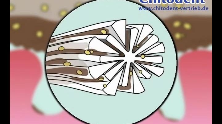 Chitodent® Microfaserfingerzahnbürste. ChitoTex Mikrofaserfingerzahnbürste von Helmuth Focken Biotechnik e.K. 