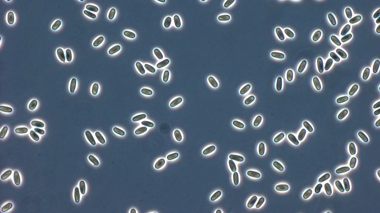 Light mMicroscopy image of microsporidian spores of Vairimorpha necatrix. Picture by Charles Vossbrinck