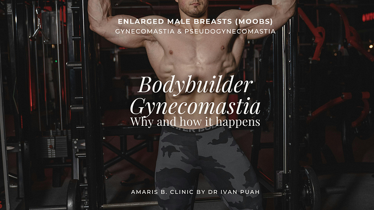 Bodybuilder Gynecomastia