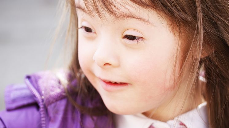 Nyfödda barn med Downs syndrom mer hjärtfriska idag