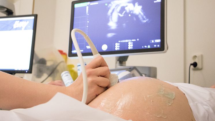 Tidigt ultraljud erbjuds till alla gravida i Västerbotten