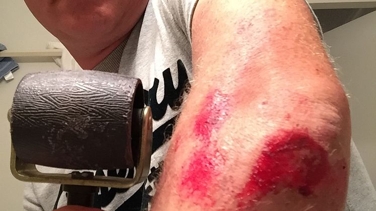 Oups! He did it again – Måns i ny krasch!