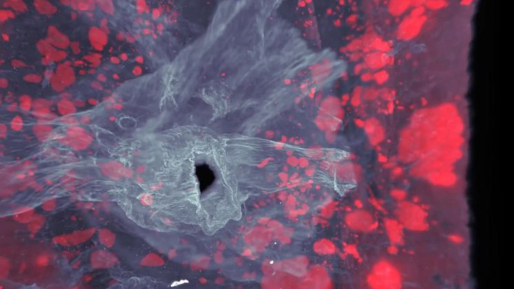 Film_3_D_pancreas.m4v
