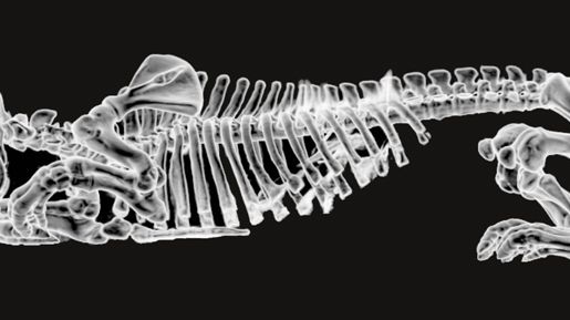 CT scan