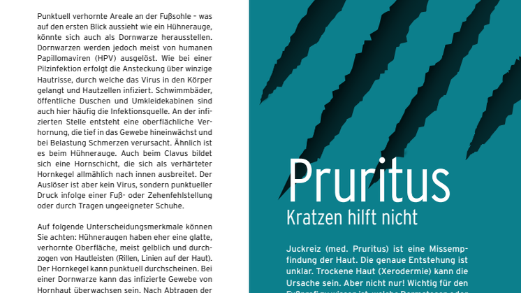 Pruritus - Kratzen hilft nicht
