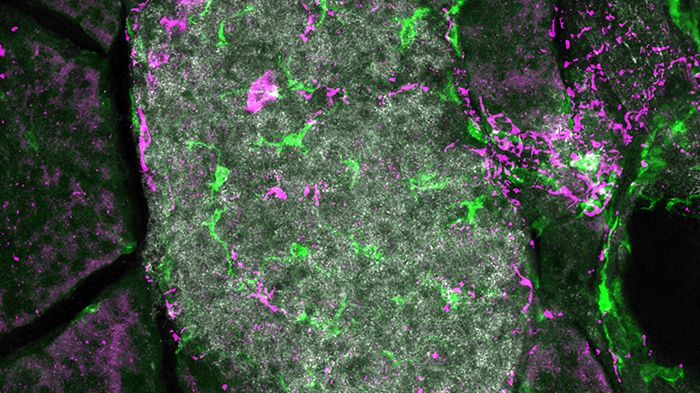 Sympatiska nervfibrer (magenta) kan ses i nära anslutning till makrofager (en typ av immuncell, gröna) i en Langerhansk cellö (grå) i bukspottkörteln från en mus.
