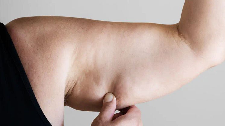 Why Do I Still Have Big Arms After Losing Weight?