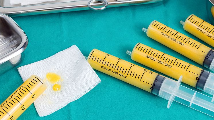 Fat grafting for the hands, face, breasts, and buttocks