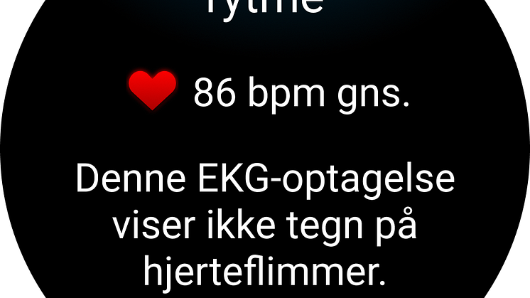 Garmin EKG app watch screen.png