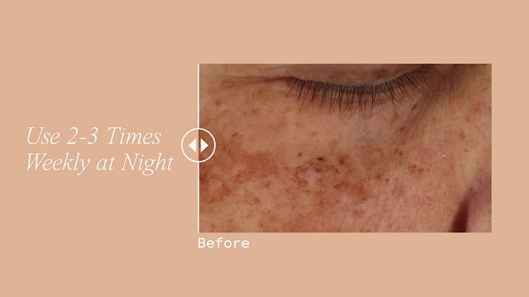 Dr Dennis Gross Advanced Retinol + Ferulic Overnight Texture Renewal Peel