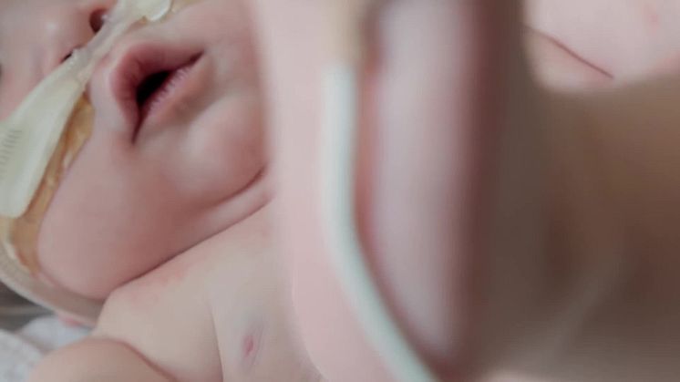 Isansys: wireless technology helps save children’s lives