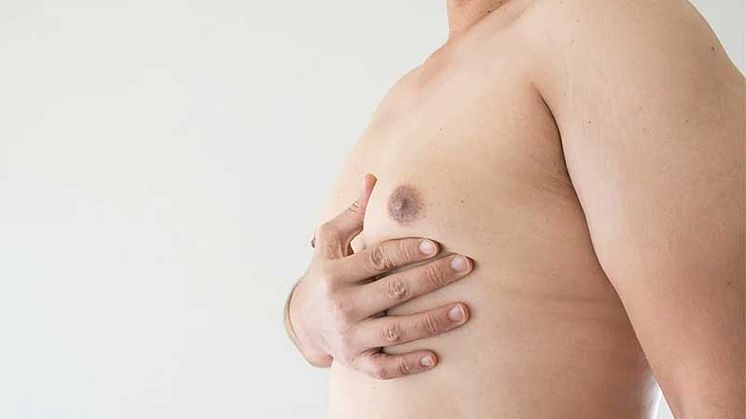 Fixing Male Chest Fat With Fat Freeze (Cryolipolysis): Is It A Bad Idea?