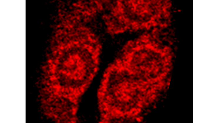 ZC3_bild1