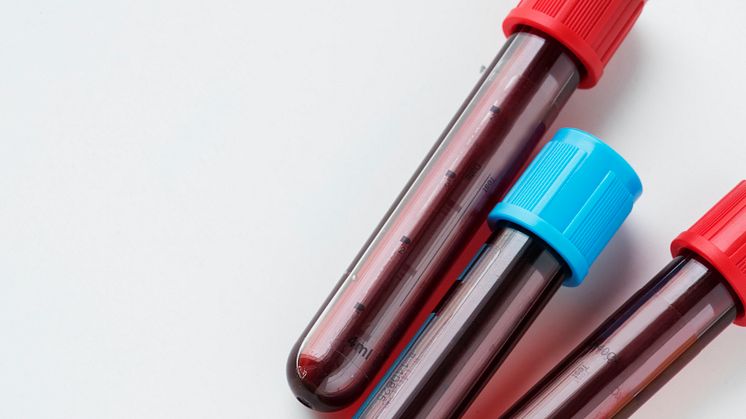 Ein Bluttest auf Eisenmangel kann zur Vorbeugung von Krankenhausaufenthalten wegen entgleister Herzschwäche beitragen. (Foto: rawpixel.com / de.freepik.com)
