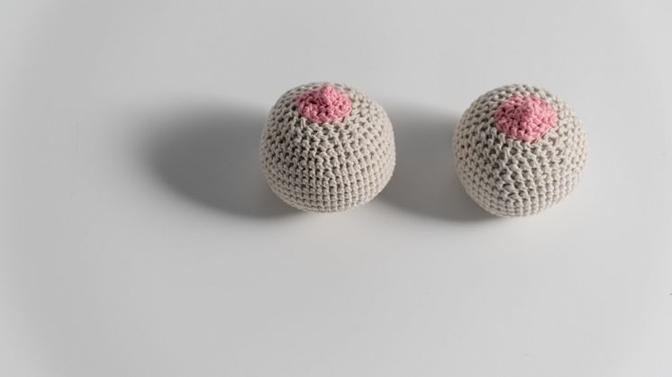 Accessory breast tissue: Can a woman have three breasts?