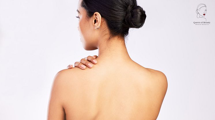 Queen of Beauty introduces Trapezius Tox injections in London for the price of £290. Book Now! 