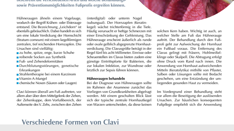 Hühneraugen: Im Blick des Fußprofis