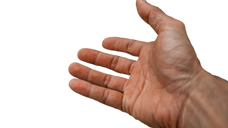 När nöden är som störst ska hjälpen inte vara dagar bort, utan stöd och konkreta förslag på lösningar måste en medlem få raskt, säger Bo Ericsson.