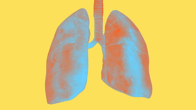 RYBREVANT®▼ (amivantamab) plus LAZCLUZE®▼ (lazertinib) visar signifikant fördelaktig total överlevnad hos patienter med EGFR-muterad icke småcellig lungcancer i jämförelse med osimertinib 