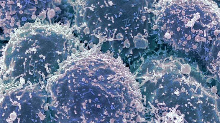 Lungcancerceller