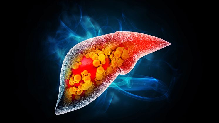 Research suggests an increased risk of fatty liver in coeliacs