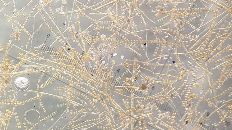 Diatoms sampled during the spring bloom in the Barents Sea. Marine microalgae bind CO2 through photosynthesis, producing organic carbon and oxygen. Photo: Eva Leu/Akvaplan-niva