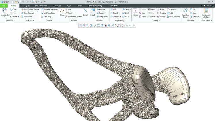 Technischer Durchbruch bei individuellen medizinischen Implantaten