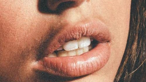 Lip Filler København.jpeg