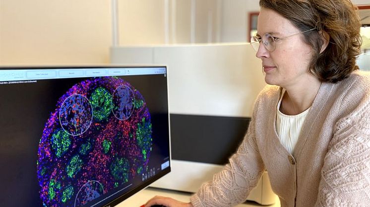 Utvecklar mer individanpassad diagnostik och behandling för patienter med lymfom