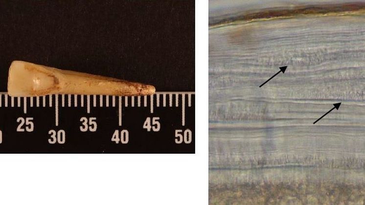 Archaeological sample of a tooth and a magnified image showing variations in the tooth's cementum rings from smoking