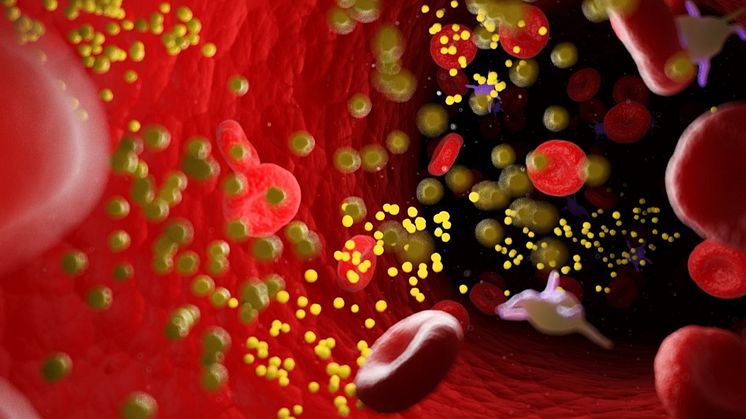 Ribo's siRNA asset RBD5044 receives Clinical Trial Authorization from Swedish MPA for a Phase II trial in patients with mixed dyslipidemia