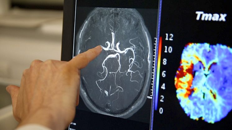 brain scan