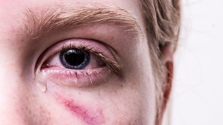 Hur barndomstrauma påverkar hjärnans utveckling – ny forskning förklarar neurobiologin bakom Pixabay CCO